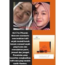 Ramai yang telah berpuas hati setelah 2 minggu menggunakan nour ain. Nourainskincarebangi Instagram Posts Photos And Videos Picuki Com