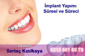 Sgk diş yaptırma fiyatları , implant için diş başına 90 tl olarak belirlenmiştir. Dis Cekildikten Kac Gun Sonra Implant Veya Kopru Yapilir