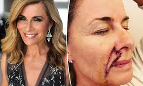 She was involved in the 12 month process from design to the very last coat of natural oil on her mafi wood floor. Deborah Hutton 58 Reflects On Her Life Six Months After Skin Cancer Surgery On Her Face Daily Mail Online