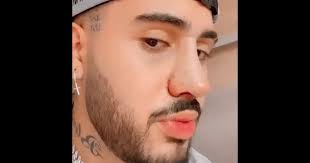 Você deve selecionar uma das três opções antes de enviar. Kevinho Mostra Resultado De Rinoplastia E Agita Web Afinou Um Pouco Foto Purepeople
