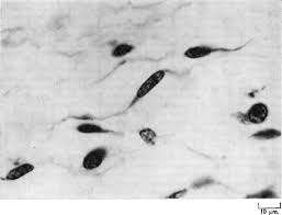 Image result for Moon White 1980 ABB Comeng