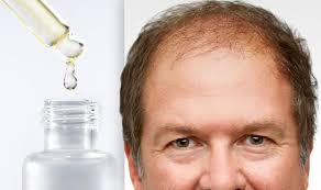 The juice of aloe vera plant helps in preventing hair loss. Hair Loss Treatment Prevent Alopecia And Stimulate Hair Growth With Lemon Juice Express Co Uk