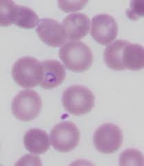 Image result for Red Blood Cell