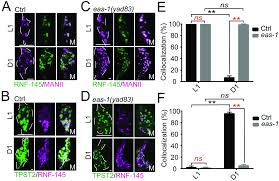 Check spelling or type a new query. Regulation Of Glial Size By Eicosapentaenoic Acid Through A Novel Golgi Apparatus Mechanism