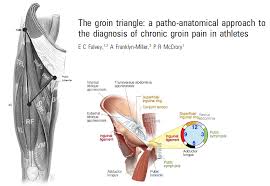 Posted by anonymous on jan 29, 2014. Hip Athletic Groin Pain Part 1 Rayner Smale