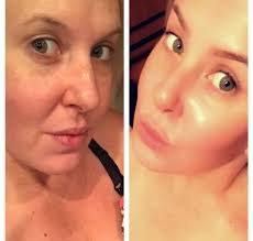 With so many treatments available, pick what makes your heart skip a beat!  Schedule your visit at Skin Lylee and indulge in some well-deserved  pampering! See you soon! Love, Amber. www.skinlylee.com