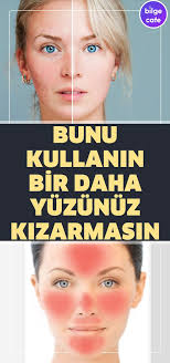 Yuz Kizarikligi Nasil Giderilir Pratik Yontem Cilt Urunleri Dogal Cilt Bakimi Dogal Saglik