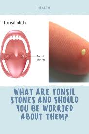 Pin On Healthy Mind Healthy Body