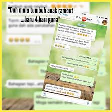 Kenapa rambut banyak gugur semasa puan hamil? Dah Mula Tumbuh Anak Rambut Baru 4 Hari Guna Mira Jika Korang Dah Penat Guna Macam Macam Tapi Tak Ada Perubahan Cuba Lah Prg Insyaallah Ada Perubahan