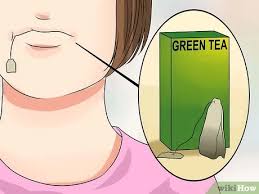 Wisdom teeth happen to be the last teeth to protrude from the gums. 3 Ways To Stop Wisdom Tooth Pain Wikihow