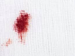 Versez du talc sur la tache et posez dessus une bonne épaisseur de papier absorbant. Comment Nettoyer Et Enlever Des Taches De Sang Dans Notre Maison