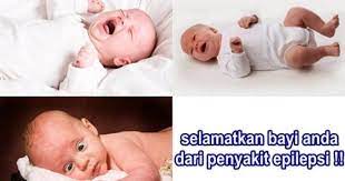 Penyakit Epilepsi Pada Anak Cara Terbaik Untuk Menghindari Komplikasi Adalah Untuk Menemukan Pengobatan Yang Membantu Pasien Kebanyakan Epilepsi Penyakit Anak