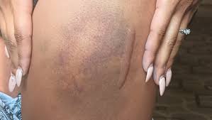 Fundraiser by Holly Bostic : Support LeeAisha's therapy