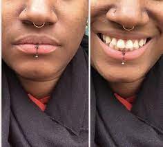 Reddit Piercing Finally Got My Vertical Labret After Much Internal Debate I Decided To Just Go Fo Vertical Labret Piercing Body Piercings Mouth Piercings