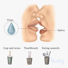 Mono caused by ebv is most common among teens and adults. Mononucleosis Infection Causes Of Mono Common Questions