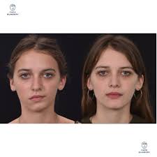 Face Surgery (@face_surgery_parma) • Instagram photos and videos