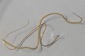 The itchiness tends to be worse or more noticeable at night, and can sometimes wake a person with pinworms. Horsehair Worms Entomology