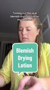 Mario Badescu'S Solution For Popped Pimples - Youtube