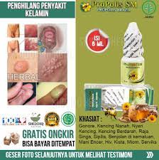 Sipilis primer sipilis jenis ini ditandai dengan luka (chancre) di tempat bakteri masuk. Obat Untuk Penyakit Raja Singa Pada Wanita Dan Pria Obat Alami Raja Singa Atau Sipilis Berkualitas Obat Herbal Raja Singa Tanpa Efek Samping Obat Antibiotik Buat Atasi Raja Singa Tradisional Bkn Cina