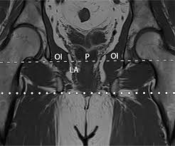 The muscles of the pelvis form its floor. Mri Of The Male Pelvic Floor Radiographics
