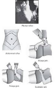 Image result for Supinator Reflex