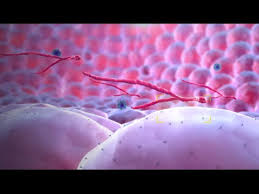 This prevents the virus from entering and infecting cells. Ebola Virus Mechanism Of Action 3d Medical Animation Youtube