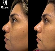 TovarDent (@tovardental_esthetic) · Quevedo