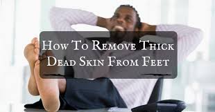 Skin diseases like eczema and psoriasis can create scaling on the feet, making the skin thicker. How To Remove Thick Dead Skin From Feet Profeethub