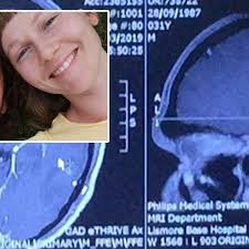 Australia news: NSW man told he has golf ball size brain tumour