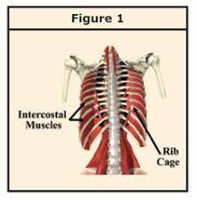 A sudden and sharp pain around your rib cage indicates that an injury or muscle pull. 10 Best Intercostal Muscle Strain Ideas Intercostal Muscle Strain Muscle Strain Muscle