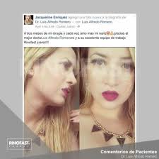 Rinoplastia en Ciudad Juárez y EL Paso, TX