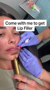 Obsessed!! 💋😍@Cherry Medical Aesthetics @Lauren Marion