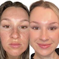 Candela Medical UK &...