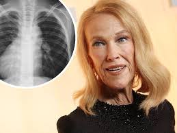 Former cop wary of Byron Bay booze fest