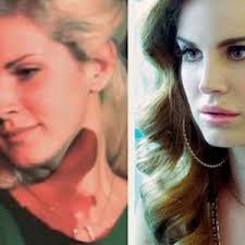 Lana del rey to plastic surgery. What Fillers Do You Think Celebrities Like Megan Fox And Lana Del Rey Use For Their Lips Photo