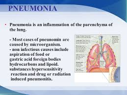 Medrockets Notes On Pneumonia Facebook