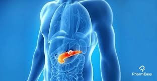 One of the first signs of pancreatic cancer can be jaundice, also known as icterus, which is the yellowing of the skin, eyes and mucus membranes due to too much bilirubin in the bloodstream. Diabetes And Pancreatic Cancer What You Should Know Pharmeasy Blog