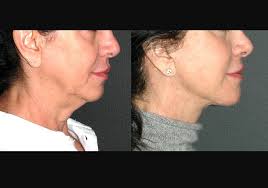 Andrew Jacono, MD, FACS (@drjacono) • Instagram photos and videos