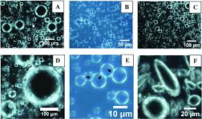 Image result for Polarized Microscopy