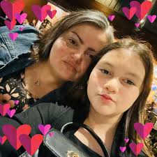 How bad do parrot bites actually hurt?