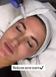 Lindsey Pennington, M.D. Facial Plastics