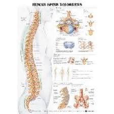 Human Spine Disorders Anatomical Chart Laminated