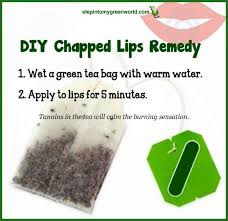 Best Diy Chapped Lips Remedy Chapped Lips Remedy Chapped Lips Remedies