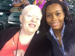 They believed that she should be stopped. People Of Color With Albinism Ask Where Do I Belong Code Switch Npr