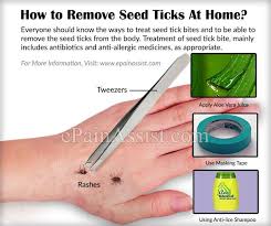 Pin On Skin Diseases