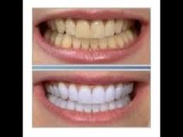 Este es un producto que se utiliza para desintoxicar ya que atrapa las toxinas y en el caso de los dientes, absorbe los microorganismos que forman la placa. Blanquea Tus Dientes En Casa Youtube