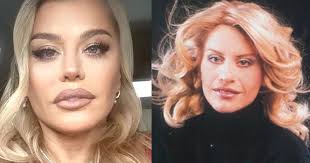 Jun 23, 2021 · sâmbătă 26 iunie 2021. Are Sau Nu Loredana Groza OperaÈ›ii Estetice Nu Sunt Impotriva Lor