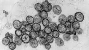 Discover 10 common hantavirus symptoms at 10faq health and stay better informed to make healthy living decisions. Hantavirus Was Ist Das Hantavirus Und Wie Erkenne Ich Die Symptome Augsburger Allgemeine