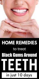 Black Gums Around Teeth Causes Best Home Remedies To Treat It Naturally Teeth Teethwhitening Oral Oralcarepro Black Gums Oral Care Oral Care Routine
