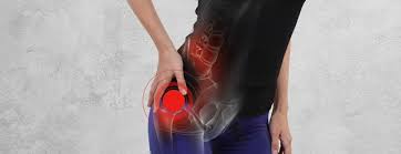 Muscles of the gluteal region: Hip Pinning Johns Hopkins Medicine